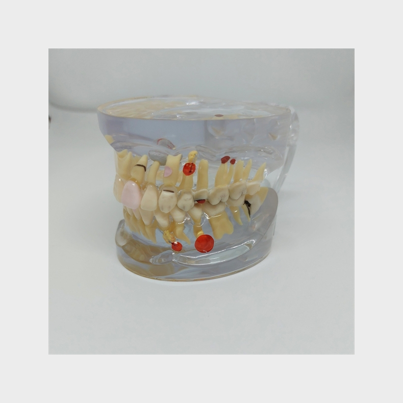 Transparent Sygdomsmodel